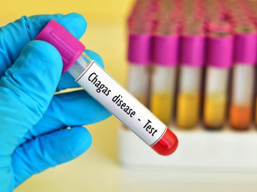 Vials of blood ready to test for Chagas disease