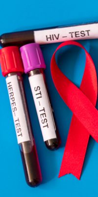 What is Public Health? | Celia Scott Weatherhead School of Public Health and Tropical Medicine Vials of blood with labels STI testing, HIV test, Herpes test, and a red AIDS ribbon